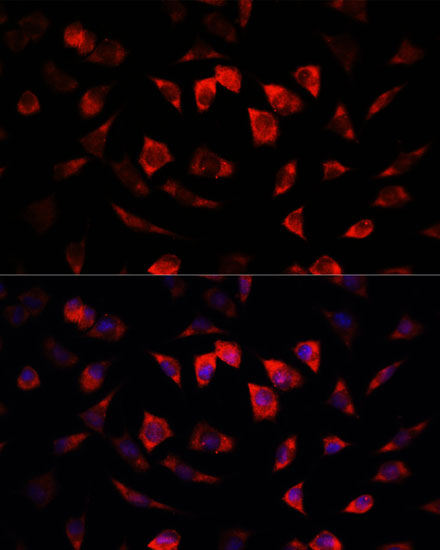 Immunofluorescence analysis of L929 cells using IGFBP4 Polyclonal Antibody at dilution of  1:100. Blue: DAPI for nuclear staining.