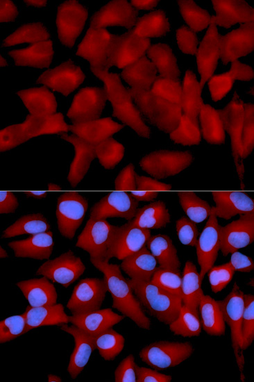 Immunofluorescence analysis of U2OS cells using EIF5A Polyclonal Antibody