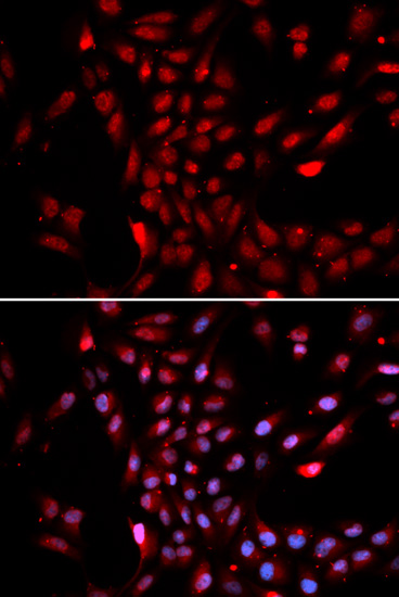 Immunofluorescence analysis of U2OS cells using KPNA4 Polyclonal Antibody