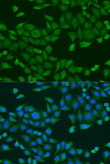 Immunofluorescence analysis of U2OS cells using RPS27A Polyclonal Antibody at dilution of  1:100. Blue: DAPI for nuclear staining.