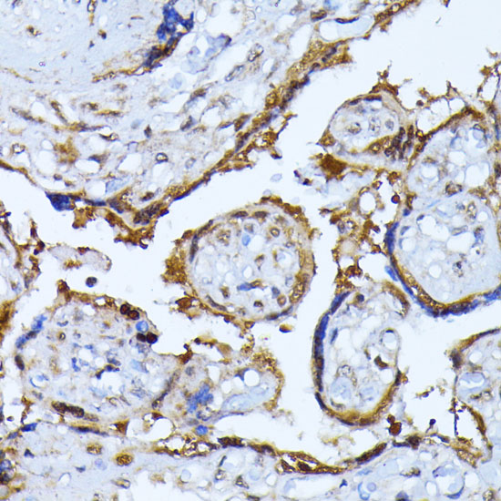 Immunohistochemistry of paraffin-embedded Human placenta using RPS27A Polyclonal Antibody at dilution of  1:100 (40x lens).