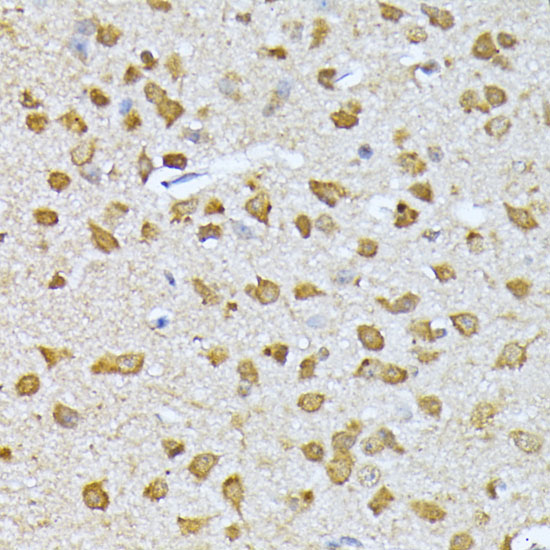 Immunohistochemistry of paraffin-embedded Mouse brain using RPS27A Polyclonal Antibody at dilution of  1:100 (40x lens).