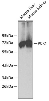 Western blot analysis of extracts of various cell lines using PCK1 Polyclonal Antibody.