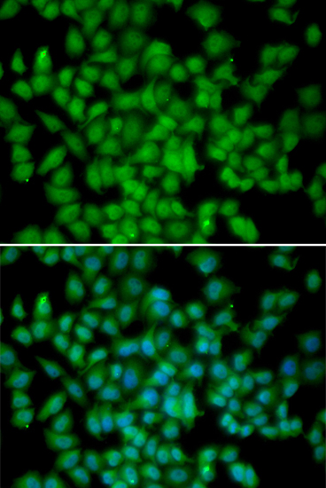 Immunofluorescence analysis of HeLa cells using CDKN2C Polyclonal Antibody