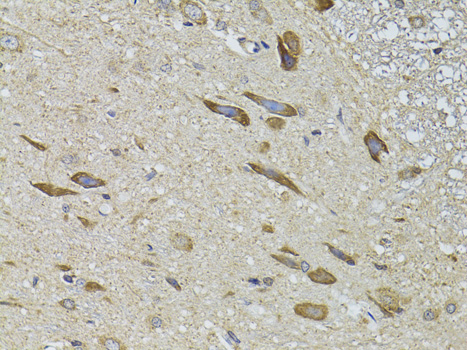 Immunohistochemistry of paraffin-embedded Rat spinal cord using ADRBK2 Polyclonal Antibody at dilution of  1:100 (40x lens).