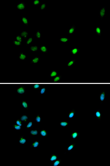 Immunofluorescence analysis of A549 cells using RUNX1 Polyclonal Antibody