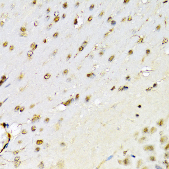 Immunohistochemistry of paraffin-embedded Mouse brain using RUNX1 Polyclonal Antibody at dilution of  1:100 (40x lens).
