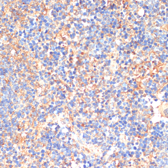 Immunohistochemistry of paraffin-embedded Mouse spleen using SIGLEC3/CD33 Polyclonal Antibody at dilution of  1:200 (40x lens).