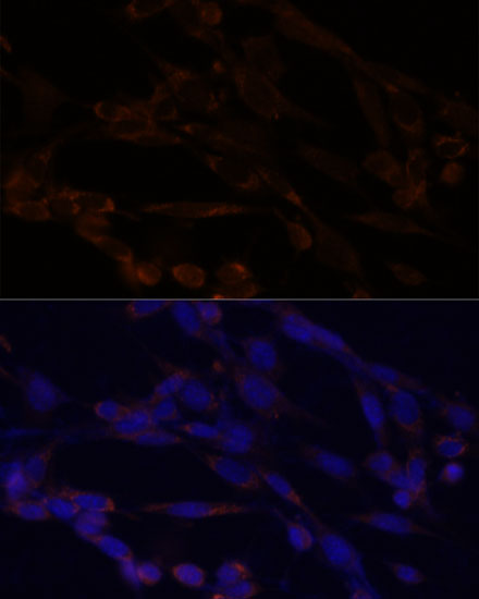 Immunofluorescence analysis of NIH/3T3 cells using IKK alpha Polyclonal Antibody at dilution of  1:100. Blue: DAPI for nuclear staining.