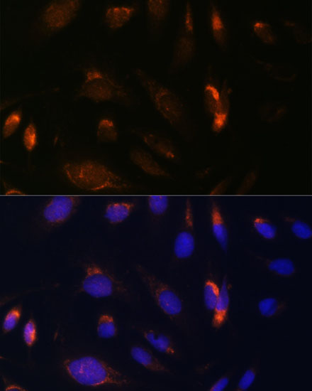 Immunofluorescence analysis of U-2 OS cells using IKK alpha Polyclonal Antibody at dilution of  1:100. Blue: DAPI for nuclear staining.