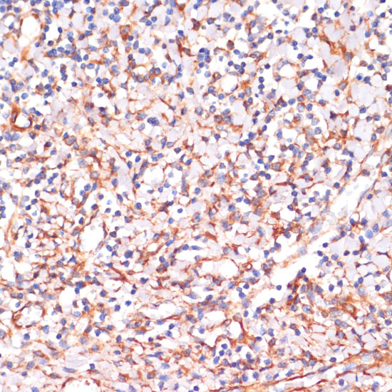 Immunohistochemistry of paraffin-embedded Human tonsil using IKK alpha Polyclonal Antibody at dilution of  1:100 (40x lens).