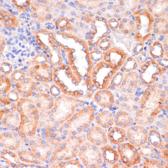 Immunohistochemistry of paraffin-embedded Mouse kidney using IKK alpha Polyclonal Antibody at dilution of  1:100 (40x lens).