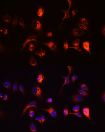 Immunofluorescence analysis of A431 cells using TOR1A Polyclonal Antibody at dilution of  1:100 (40x lens). Blue: DAPI for nuclear staining.