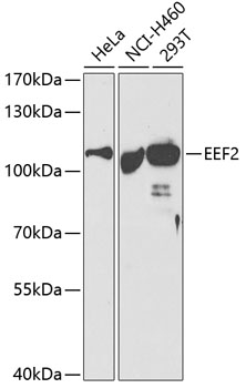 Western blot analysis of extracts of various cell lines using EEF2 Polyclonal Antibody at dilution of 1:500.