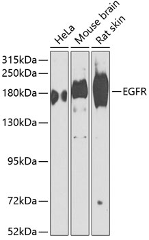 Western blot analysis of extracts of various cell lines using EGFR Polyclonal Antibody at dilution of 1:1000.