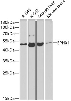 Western blot analysis of extracts of various cell lines using EPHX1 Polyclonal Antibody at dilution of 1:1000.