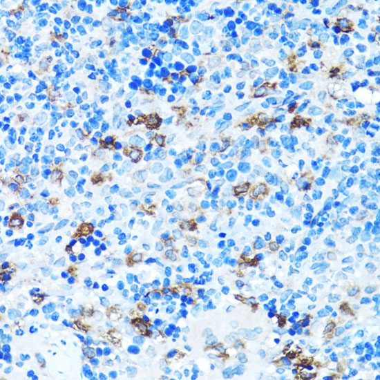 Immunohistochemistry of paraffin-embedded Rat spleen using FGFR2 Polyclonal Antibody at dilution of  1:100 (40x lens).