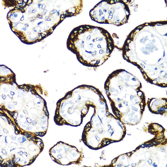 Immunohistochemistry of paraffin-embedded Human placenta using FGFR2 Polyclonal Antibody at dilution of  1:100 (40x lens).