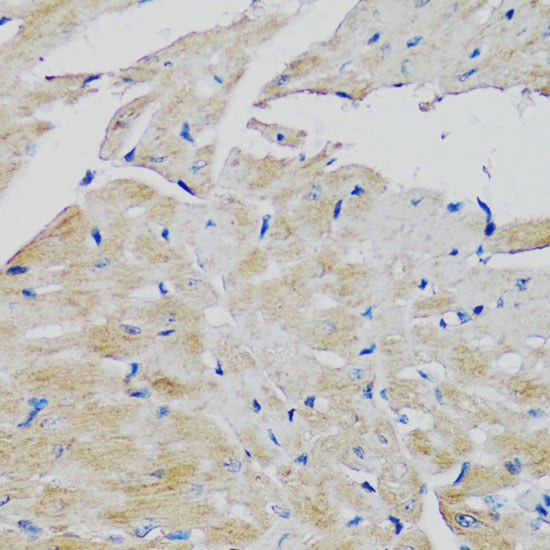 Immunohistochemistry of paraffin-embedded Mouse heart using FGFR2 Polyclonal Antibody at dilution of  1:100 (40x lens).