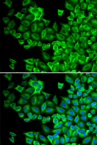Immunofluorescence analysis of A549 cells using HCK Polyclonal Antibody