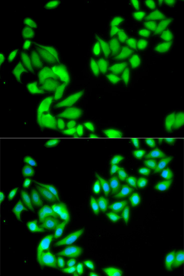 Immunofluorescence analysis of HeLa cells using IKK beta Polyclonal Antibody
