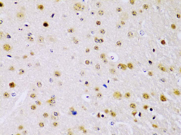 Immunohistochemistry of paraffin-embedded Mouse brain using IKK beta Polyclonal Antibody at dilution of  1:100 (40x lens).