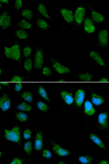 Immunofluorescence analysis of MCF-7 cells using IL1RN Polyclonal Antibody