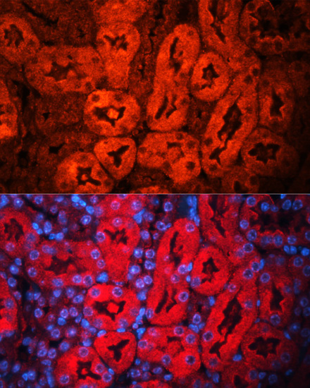 Immunofluorescence analysis of Mouse kidney using LCN2 Polyclonal Antibody at dilution of  1:100. Blue: DAPI for nuclear staining.