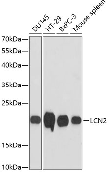 Western blot analysis of extracts of various cell lines using LCN2 Polyclonal Antibody at dilution of 1:3000.