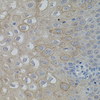 Immunohistochemistry of paraffin-embedded Human esophagus using FAK Polyclonal Antibody at dilution of  1:100 (40x lens).