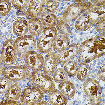 Immunohistochemistry of paraffin-embedded Rat kidney using FAK Polyclonal Antibody at dilution of  1:100 (40x lens).