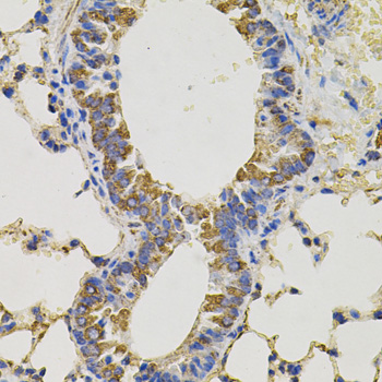 Immunohistochemistry of paraffin-embedded Mouse lung using PTPRC Polyclonal Antibody
