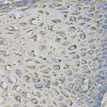 Immunohistochemistry of paraffin-embedded Human esophagus using PTPRC Polyclonal Antibody