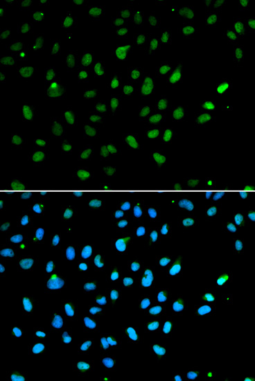 Immunofluorescence analysis of A549 cells using SMARCA4 Polyclonal Antibody