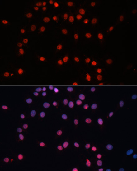 Immunofluorescence analysis of C6 cells using SUMO1 Polyclonal Antibody at dilution of  1:100. Blue: DAPI for nuclear staining.