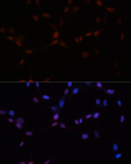 Immunofluorescence analysis of NIH-3T3 cells using SUMO1 Polyclonal Antibody at dilution of  1:100. Blue: DAPI for nuclear staining.