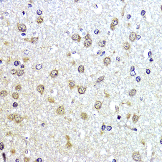 Immunohistochemistry of paraffin-embedded Rat brain using SUMO1 Polyclonal Antibody at dilution of  1:200 (40x lens).