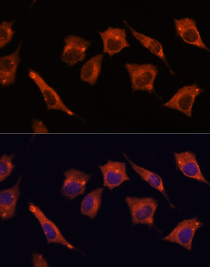 Immunofluorescence analysis of L929 cells using MALT1 Polyclonal Antibody at dilution of  1:100. Blue: DAPI for nuclear staining.