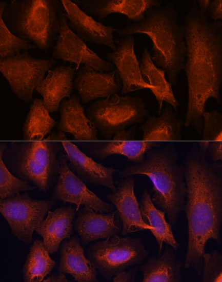 Immunofluorescence analysis of U-2 OS cells using MALT1 Polyclonal Antibody at dilution of  1:100. Blue: DAPI for nuclear staining.