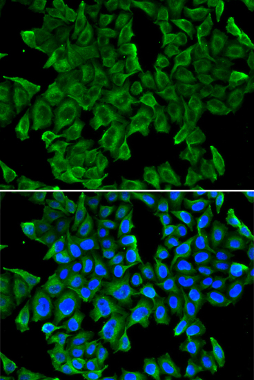 Immunofluorescence analysis of MCF-7 cells using REG3G Polyclonal Antibody