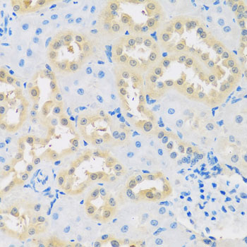 Immunohistochemistry of paraffin-embedded Rat kidney using LETMD1 Polyclonal Antibody at dilution of  1:100 (40x lens).