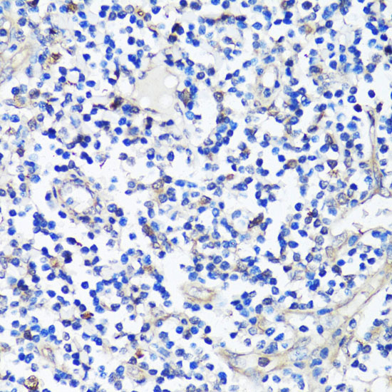 Immunohistochemistry of paraffin-embedded Human tonsil using Caspase-3 Polyclonal Antibody at dilution of  1:100 (40x lens).