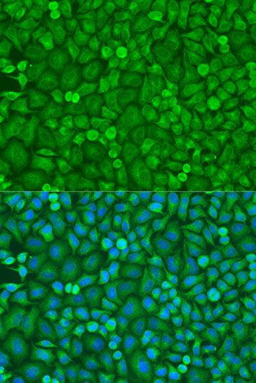 Immunofluorescence analysis of U2OS cells using EIF4E Polyclonal Antibody at dilution of  1:100. Blue: DAPI for nuclear staining.