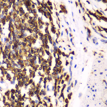 Immunohistochemistry of paraffin-embedded Human esophagus using HCLS1 Polyclonal Antibody at dilution of  1:100 (40x lens).