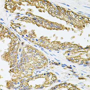 Immunohistochemistry of paraffin-embedded Human prostate using HLA-DQA1 Polyclonal Antibody at dilution of  1:100 (40x lens).