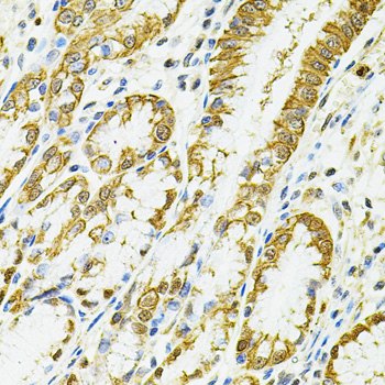 Immunohistochemistry of paraffin-embedded Human esophagus using HLA-DQA1 Polyclonal Antibody at dilution of  1:100 (40x lens).