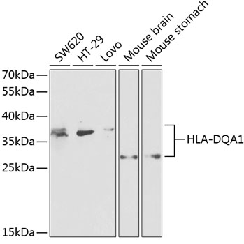 Western blot analysis of extracts of various cell lines using HLA-DQA1 Polyclonal Antibody at dilution of 1:1000.