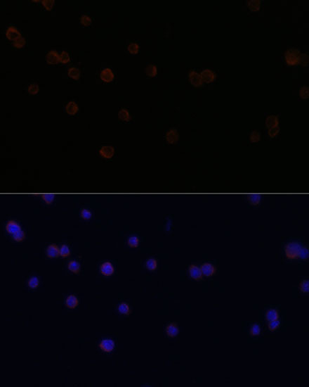 Immunofluorescence analysis of RAW264.7 cells using CD18 Polyclonal Antibody at dilution of  1:100. Blue: DAPI for nuclear staining.