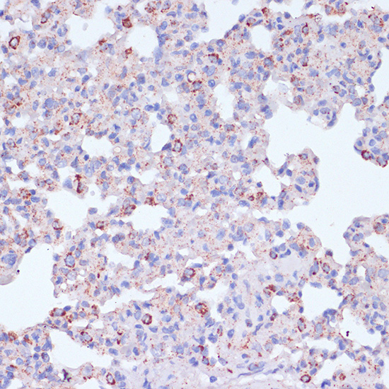 Immunohistochemistry of paraffin-embedded Rat lung using CD18 Polyclonal Antibody at dilution of  1:100 (40x lens).