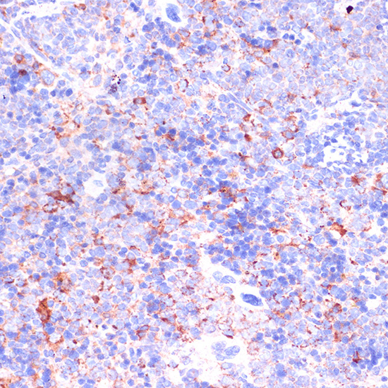 Immunohistochemistry of paraffin-embedded Mouse spleen using CD18 Polyclonal Antibody at dilution of  1:100 (40x lens).
